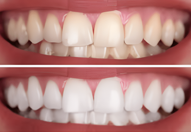 Get results like this in 16 minutes!