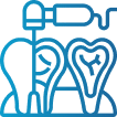 What conditions require a root canal?