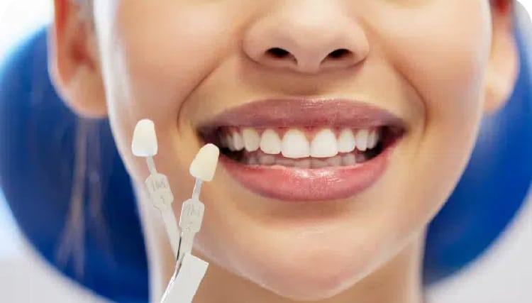 What are same-day crowns?