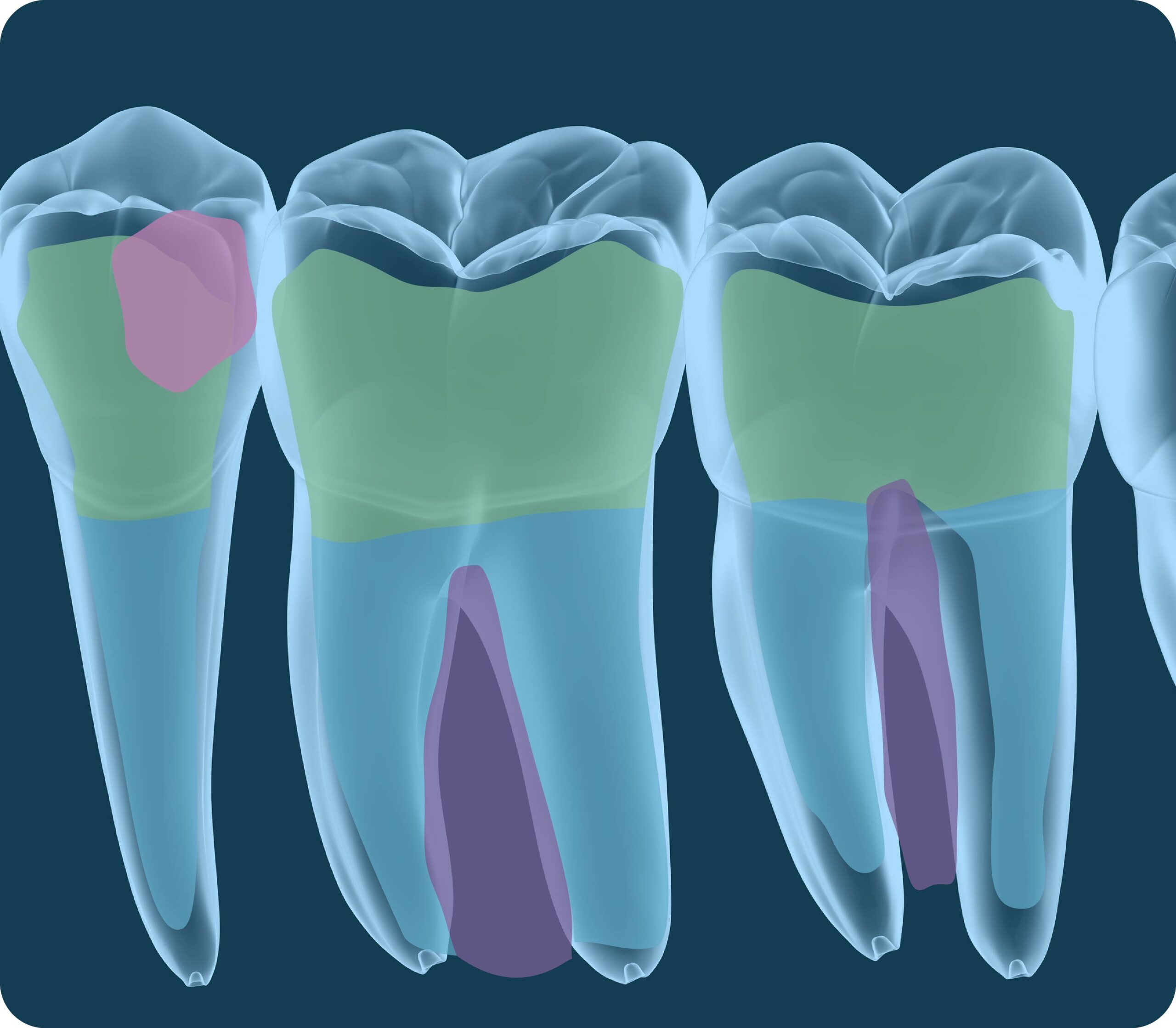 AI-Enhanced Dental Imaging 