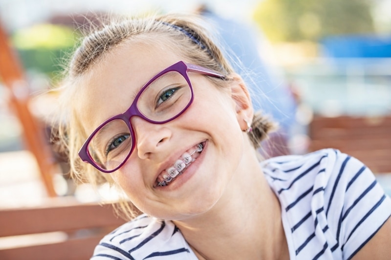 Braces and Clear Aligners